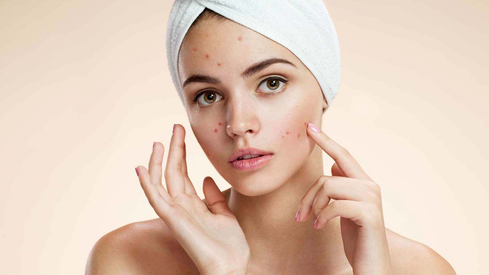 Lưu ý quan trọng trong cách chăm sóc da mặt mụn hiệu quả để giữ làn da luôn sạch sâu và thông thoáng