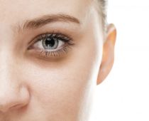 Nguyên nhân nào gây ra quầng thâm dưới mắt? Cách làm giảm quầng thâm mắt hiệu quả!