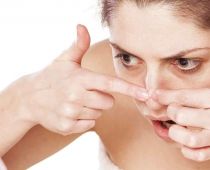 Biện pháp ngăn ngừa mụn mọc lại sau khi nặn mụn ở mũi