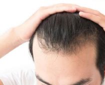 Mẹo giúp mọc tóc nhanh cho nam an toàn hiệu quả