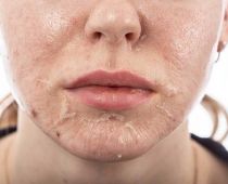 Thuốc bắc tái tạo da có tốt không? Những nguy hiểm tiềm tàng mà nó mang lại cho làn da của bạn!