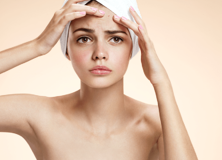 Nặn mụn đúng cách giúp mang lại nhiều lợi ích cho làn da